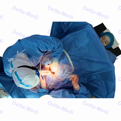 Αποστειρωμένο χειρουργικό τμήμα Drape Γ με το πακέτο Drape γυναικολογίας Obsterics δημιουργίας ανοιγμάτων στο κτιριακό έδαφος