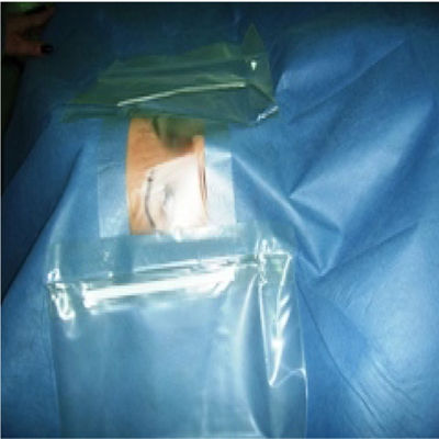 Πολλαπλάσιο στρώμα αποστειρωμένο χειρουργικό Drapes οφθαλμολογίας με τη σακούλα